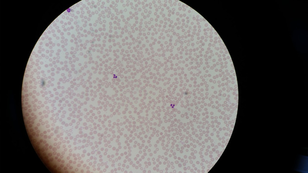 Blood Slides - Blood 001 100X